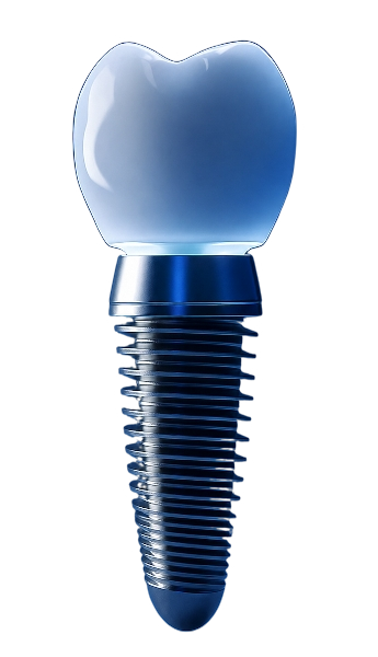 Implante Dental